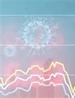 Quatre crises et une inflation